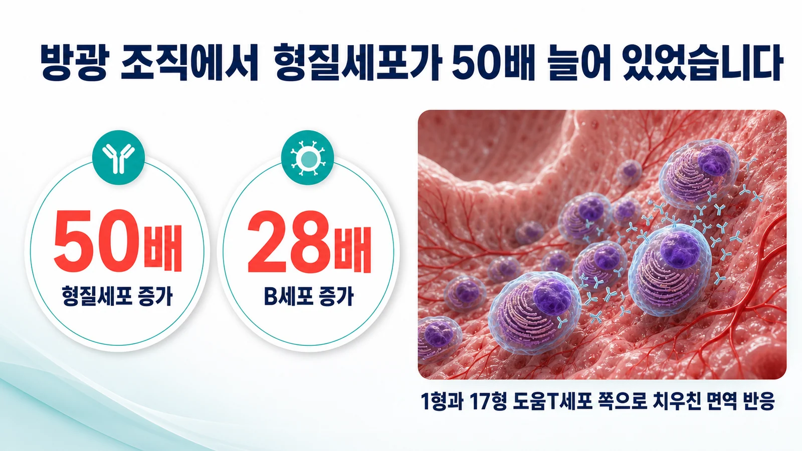 방광 조직에서 형질세포가 50배 늘어 있었다는 것을 나타낸 그림. 형질세포 50배 증가와 B세포 28배 증가가 원형 배지로 표시되고, 1형과 17형 도움T세포 쪽으로 치우친 면역 반응이라는 설명이 붙어 있다