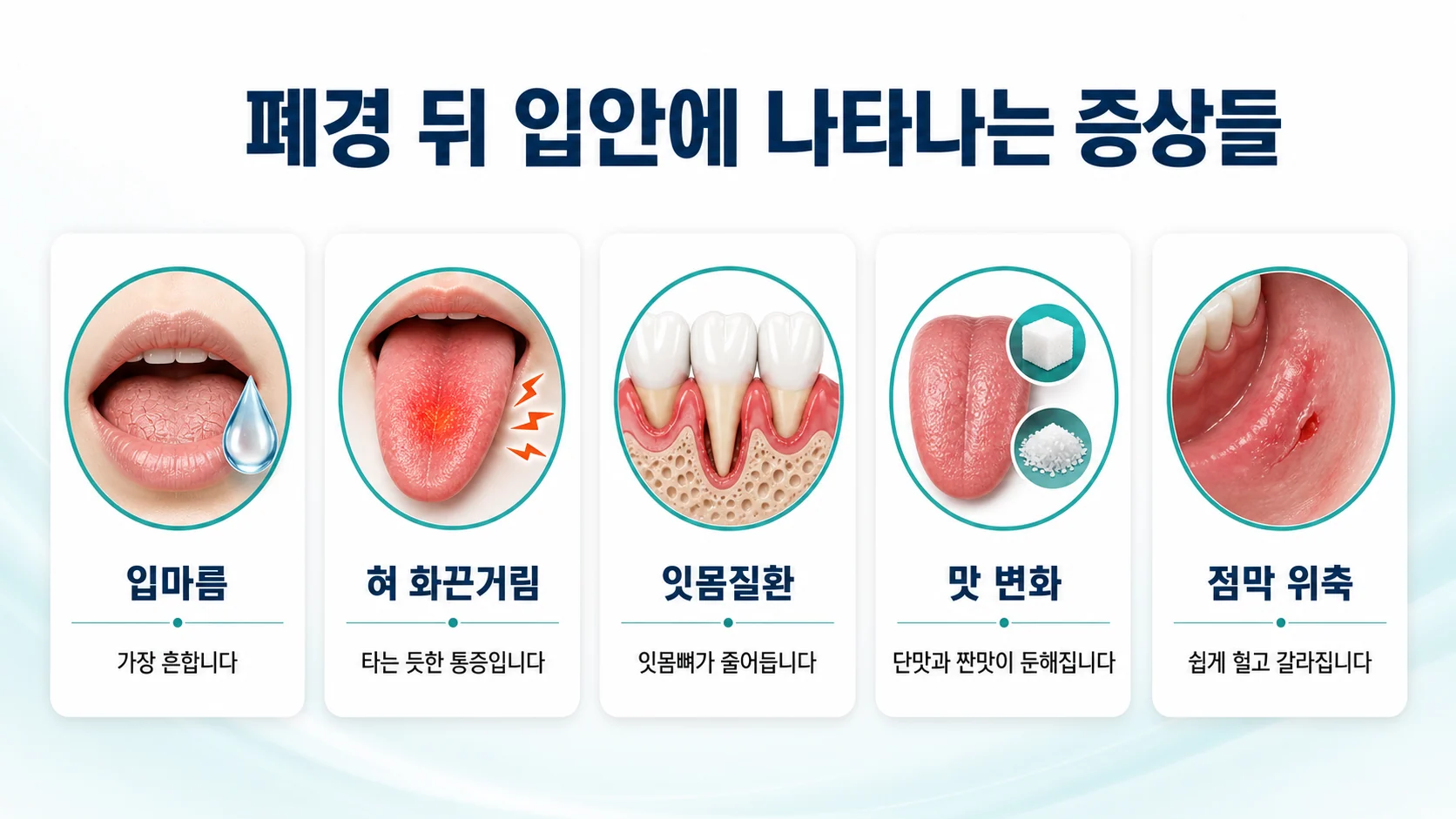 폐경 뒤 나타나는 다섯 가지 입안 증상을 카드로 정리한 이미지. 입마름, 혀 화끈거림, 잇몸질환, 맛 변화, 점막 위축