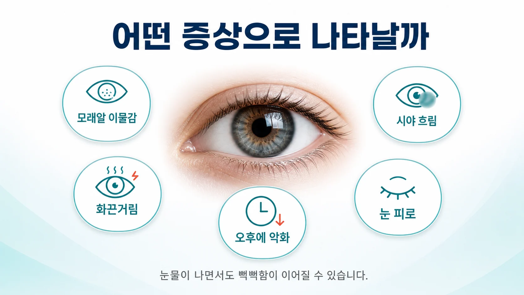건성각결막염의 이물감 화끈거림 시야 흐림 눈피로 등 증상과 오후에 악화되는 양상을 정리한 이미지