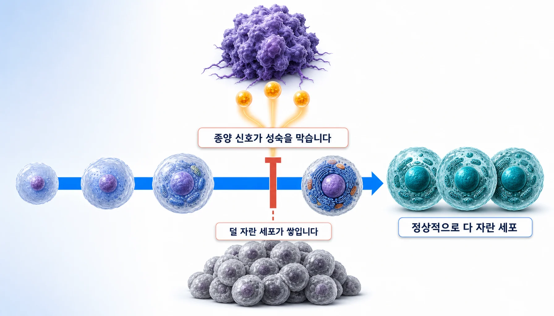 골수에서 백혈구가 자라는 과정이 종양 신호로 중간에 멈추는 모습을 그린 그림