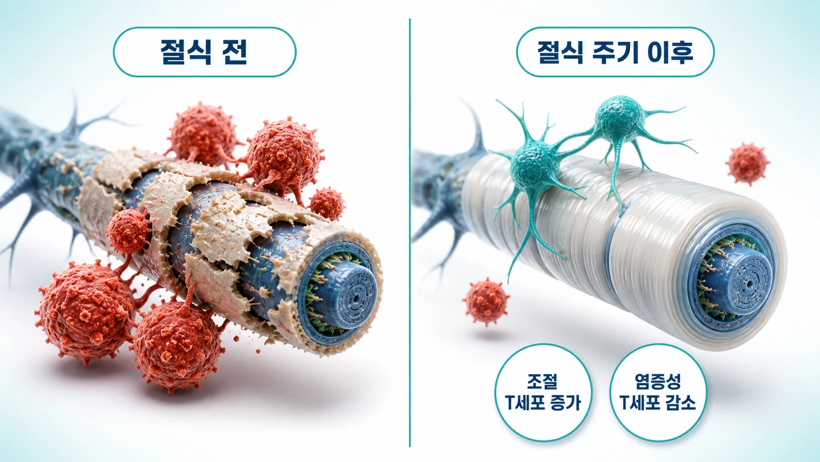 절식 주기 이후 신경섬유의 수초가 다시 만들어지고 조절 T세포가 늘며 염증성 T세포가 줄어든 변화를 절식 전과 나란히 비교한 그림