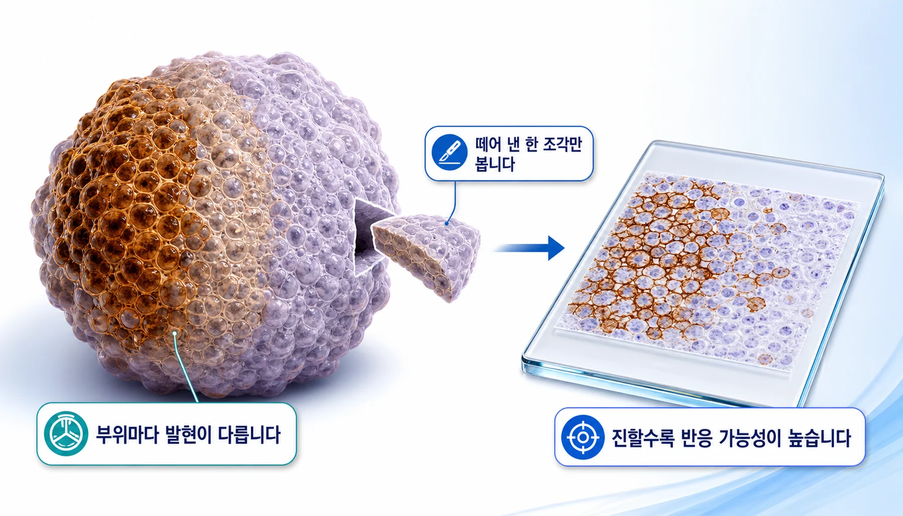 조직 염색으로 PD-L1 발현을 확인하는 검사와 그 한계를 그린 그림