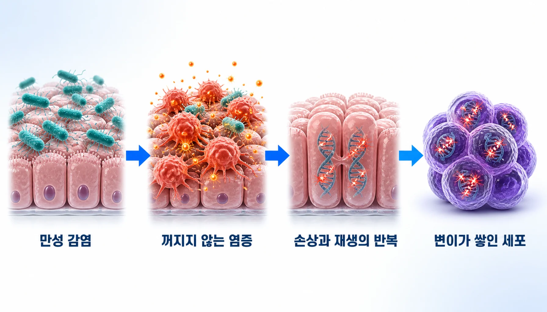 만성 감염이 염증과 재생 반복을 거쳐 변이 축적으로 넘어가는 과정을 그린 그림