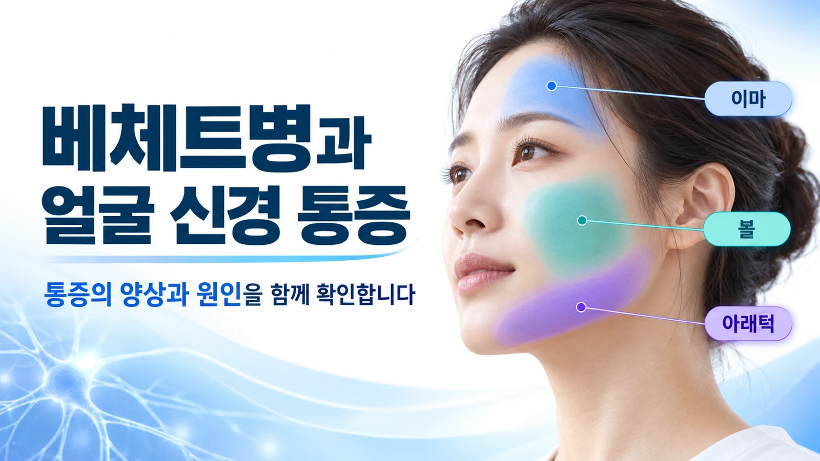 베체트병에서 얼굴 감각을 담당하는 이마와 볼 및 아래턱의 통증 부위를 설명하는 그림