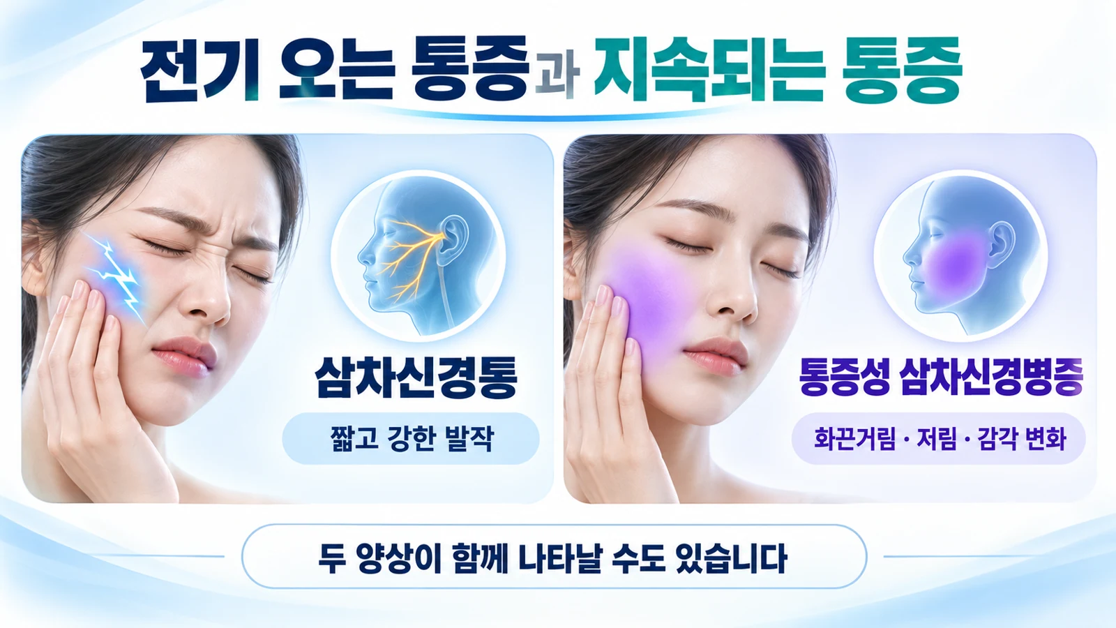 짧고 강한 발작이 중심인 삼차신경통과 지속되는 화끈거림 및 감각 변화가 중심인 신경병증을 비교한 그림