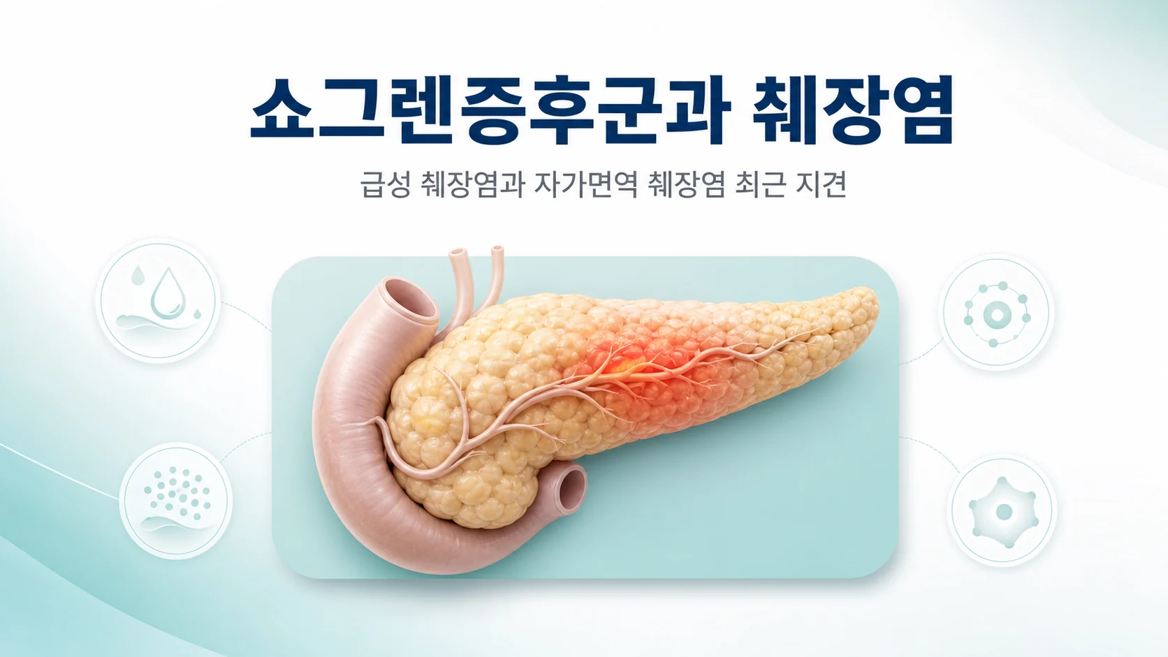 쇼그렌증후군의 급성 췌장염 위험과 췌장 외분비 기능 저하를 정리한 대표 이미지