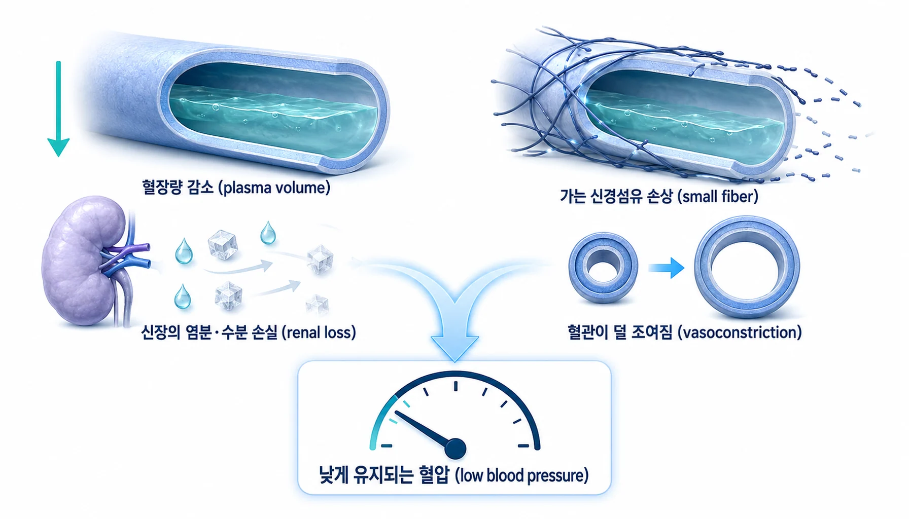 혈장량 감소와 혈관 조절 장애가 함께 작용해 혈압이 낮게 유지되는 과정을 정리한 그림