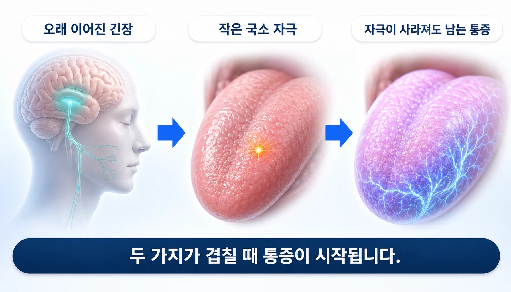 스트레스로 예민해진 상태에 국소 자극이 더해져 통증이 시작되는 두 단계를 그린 그림