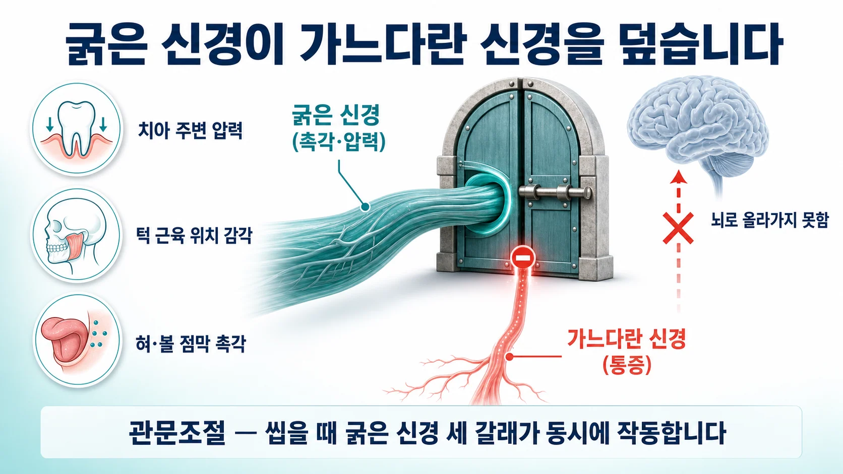 굵은 신경의 촉각 입력이 가느다란 신경의 통증 신호를 걸러내는 관문조절설 도해