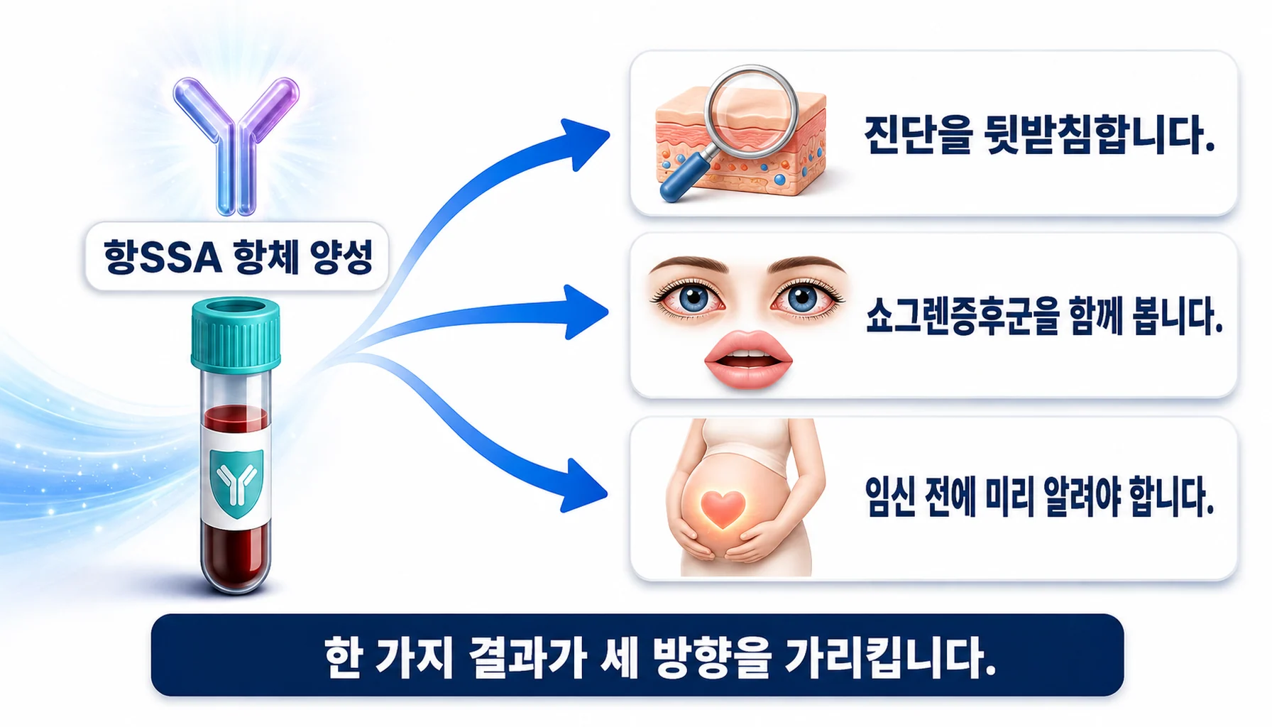 항SSA 항체 양성이 가리키는 세 가지 방향을 정리한 그림