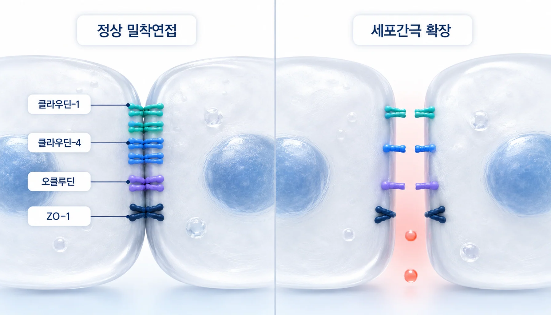 식도 상피의 밀착연접이 정상일 때와 세포간극이 넓어졌을 때를 좌우로 대비한 그림