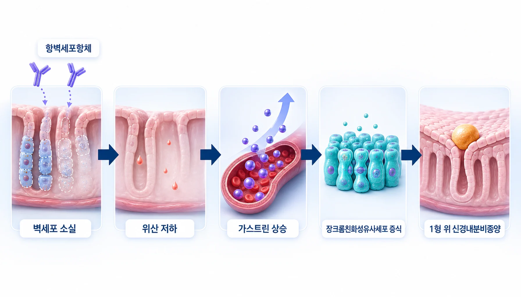 위산을 만드는 벽세포가 줄어든 뒤 가스트린이 오르고 장크롬친화성유사세포가 증식하는 연쇄를 화살표로 표시한 그림