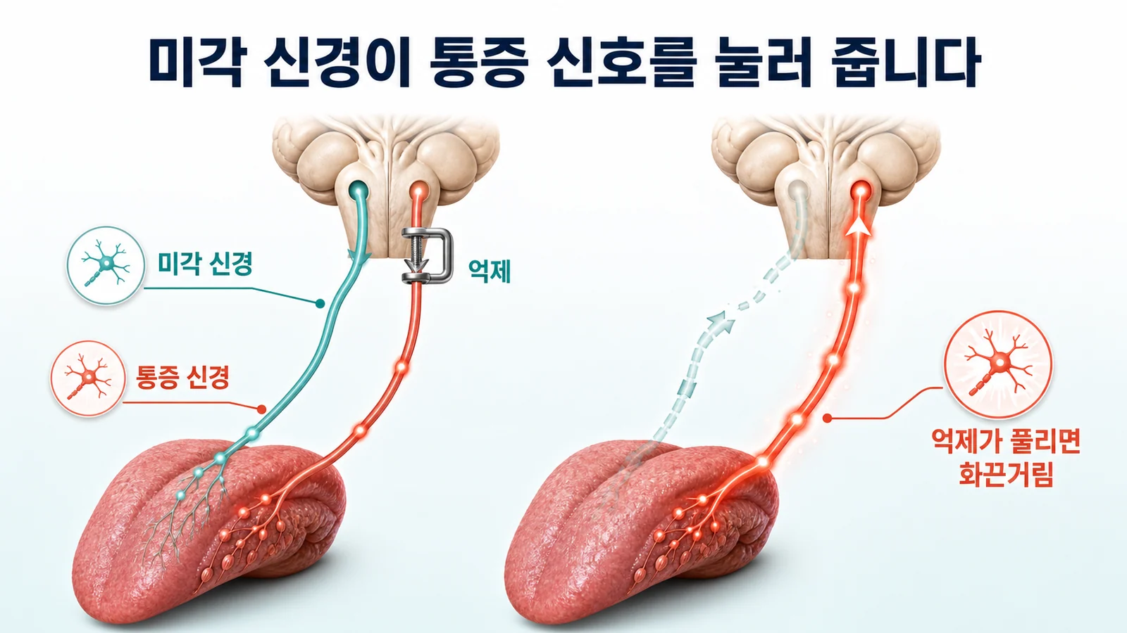 미각 신경이 통증 신호를 눌러 준다는 것을 나타낸 그림. 왼쪽은 미각 신경이 통증 신경을 억제하는 상태, 오른쪽은 억제가 풀려 통증이 강해진 상태가 표시되어 있다