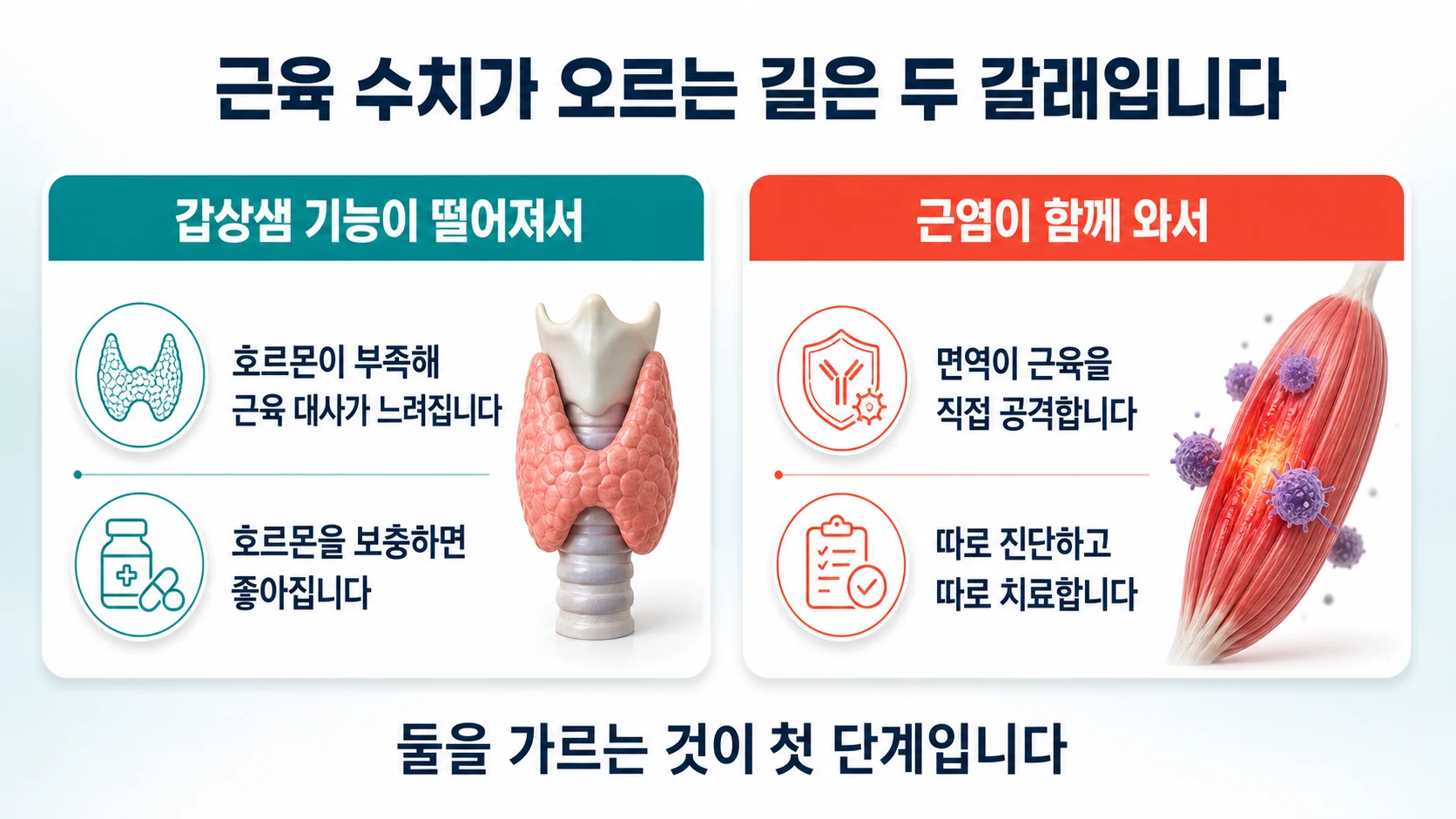 갑상샘 기능이 떨어져서와 근염이 함께 와서라는 두 가지 경우를 비교한 도식