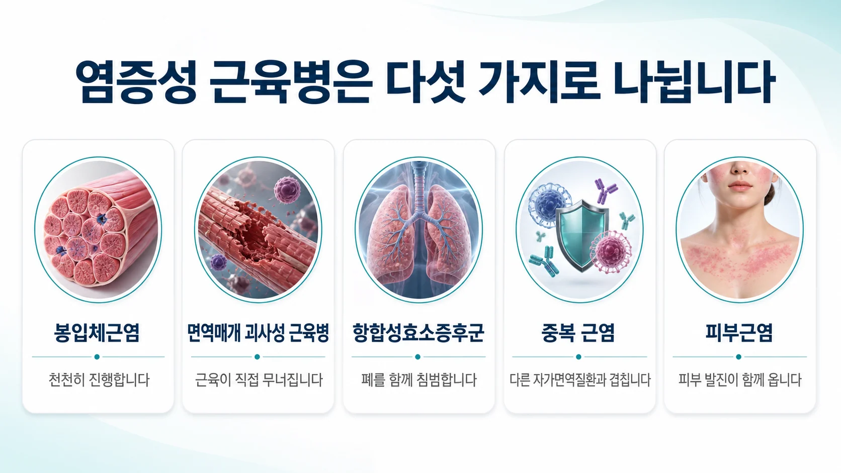 봉입체근염·면역매개 괴사성 근육병·항합성효소증후군·중복 근염·피부근염 다섯 아형을 정리한 카드