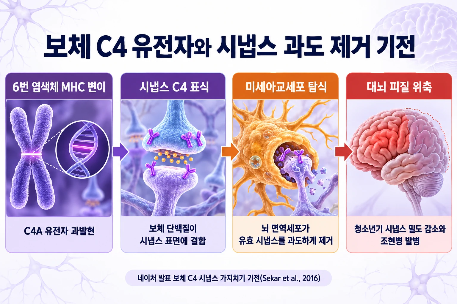 6번 염색체 MHC 영역의 C4 유전자 변이가 C4A 과발현을 유도하고 신경 시냅스 표면에 결합하여 미세아교세포의 과도한 시냅스 가지치기와 대뇌 피질 두께 감소를 유발하는 분자면역학적 과정을 단계별로 정리한 모식도