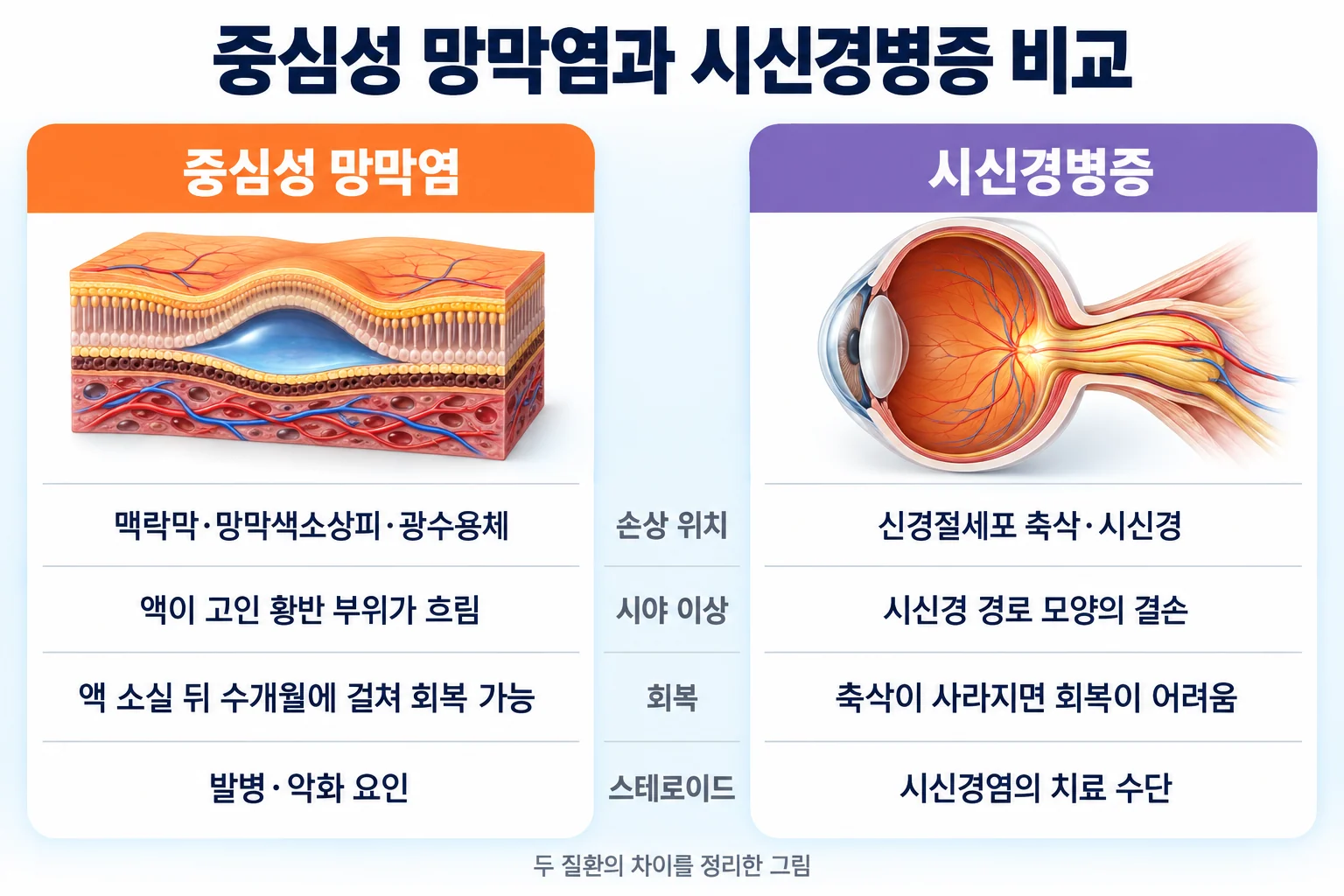 중심성 망막염과 시신경병증의 손상 위치, 시야 이상, 회복 가능성, 스테로이드와의 관계를 두 칸으로 비교한 인포그래픽