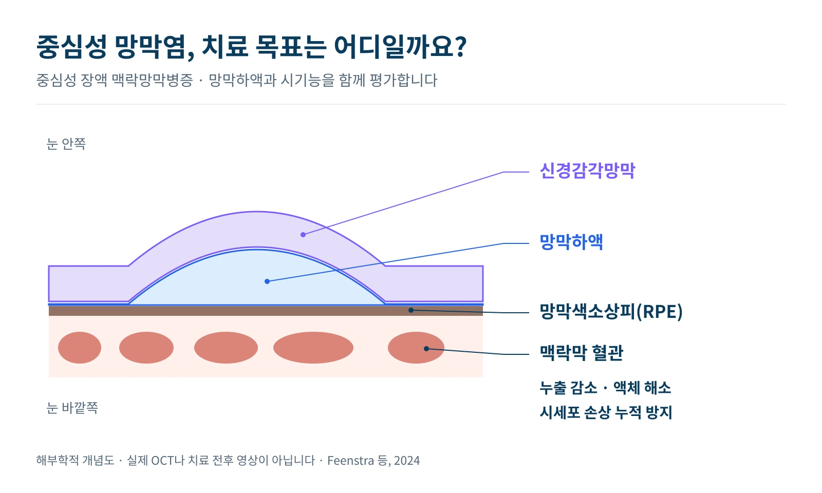 망막하액이 생기는 구조와 한의학 치료 연구의 평가 항목을 설명한 그림