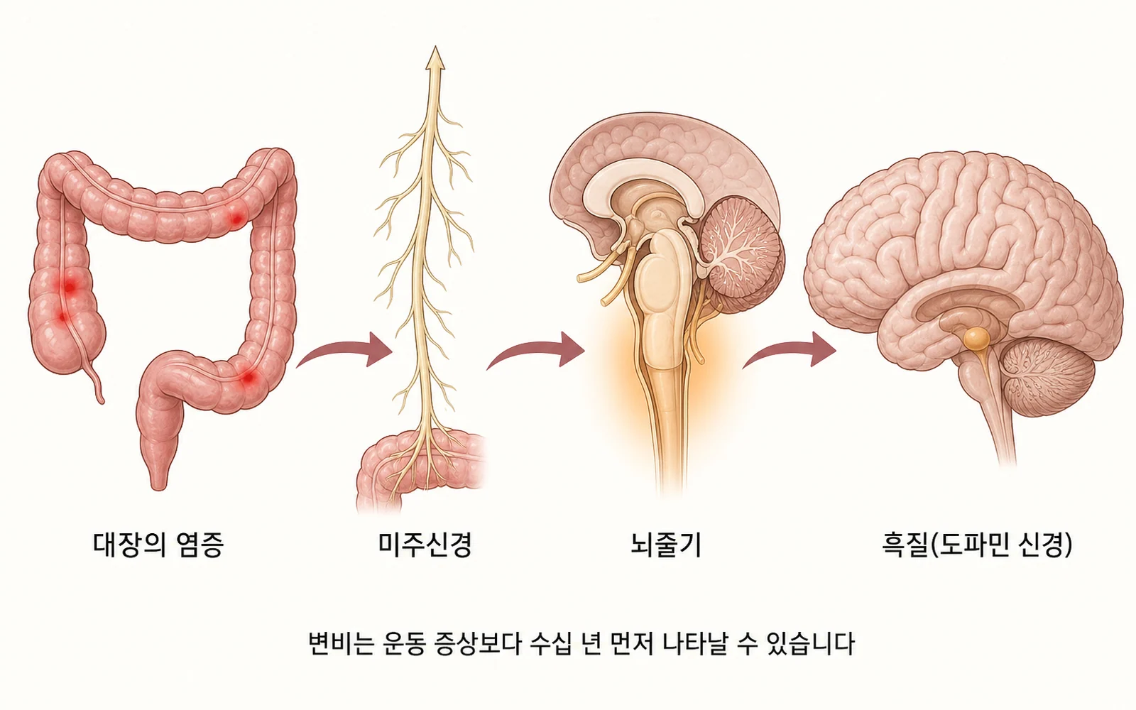 대장의 염증이 미주신경을 타고 뇌로 올라가는 경로