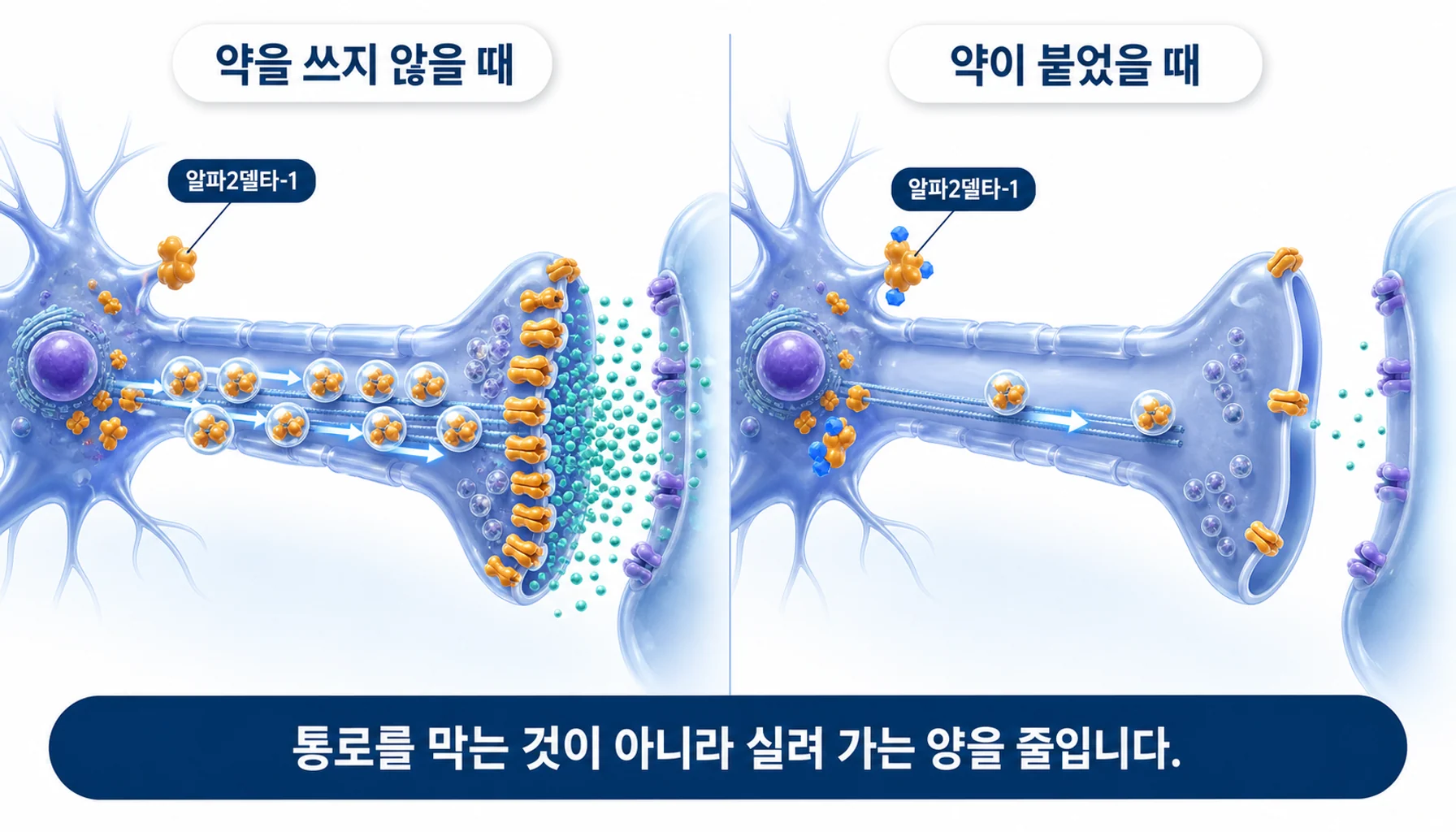 약물이 칼슘통로 보조 소단위에 결합해 신경 말단으로의 운반을 줄이는 과정을 그린 그림