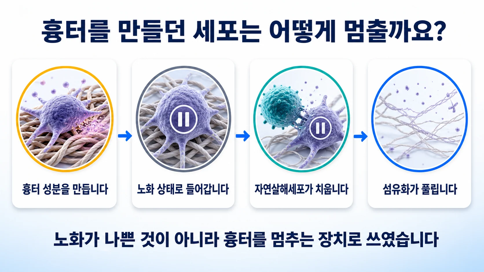 간 손상에서 노화된 세포를 자연살해세포가 치워 섬유화가 풀리는 과정을 정리한 그림