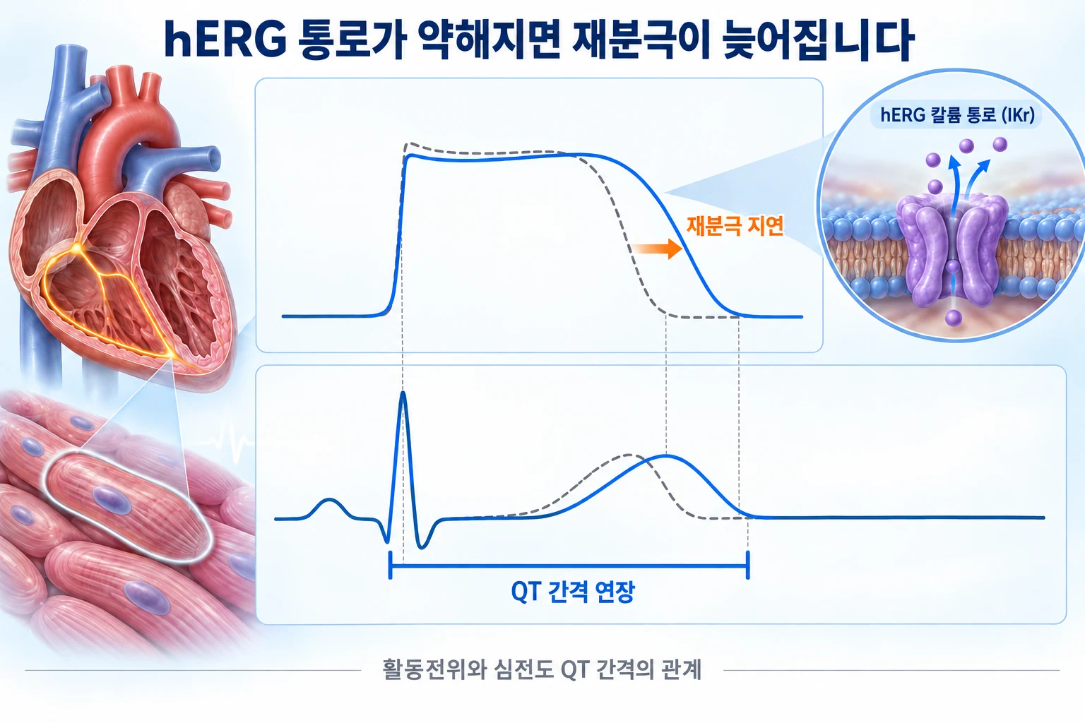 정상과 지연된 활동전위 곡선, 같은 시간축의 심전도 QT 간격 연장, hERG 칼륨 통로를 확대한 인셋을 함께 보여 주는 설명도