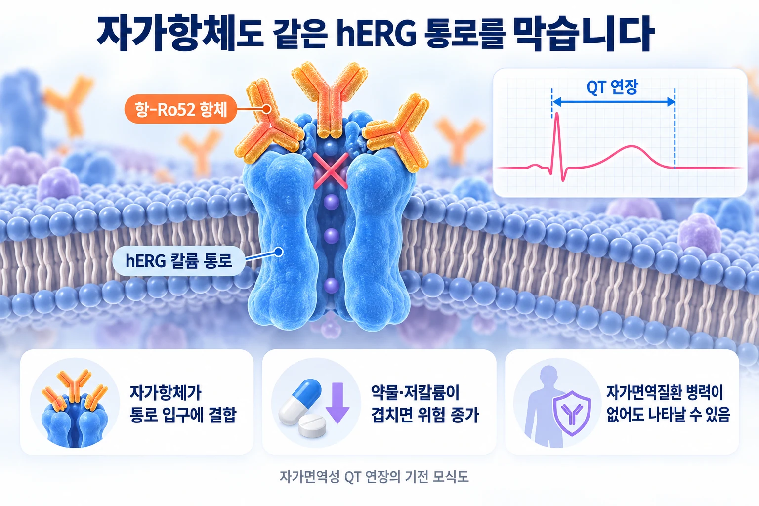 hERG 칼륨 통로의 세포 밖 입구에 항-Ro52 항체가 결합해 칼륨 흐름을 막고 QT 연장으로 이어지는 과정을 보여 주는 자가면역성 QT 연장 모식도
