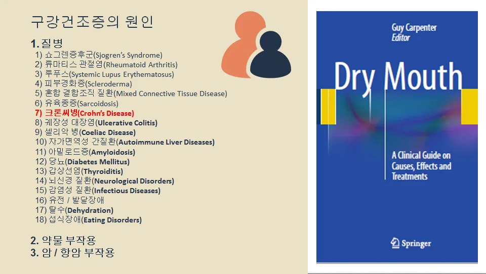 크론병 환자의 구강건조증을 설명하는 대표 이미지