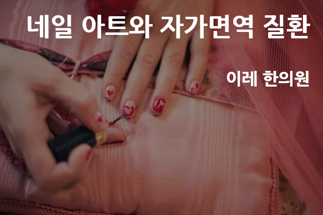 매니큐어와 자가면역질환의 관련성을 다룬 대표 이미지