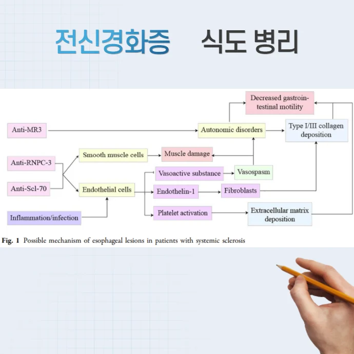 전신경화증 경피증 #2