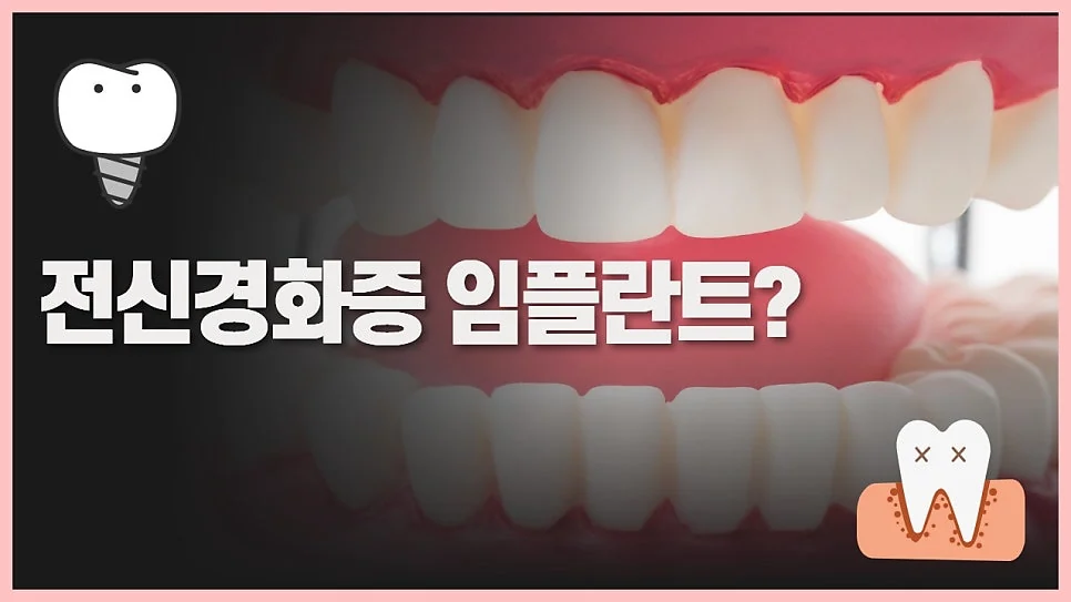 전신경화증 구강 증상과 임플란트 고민