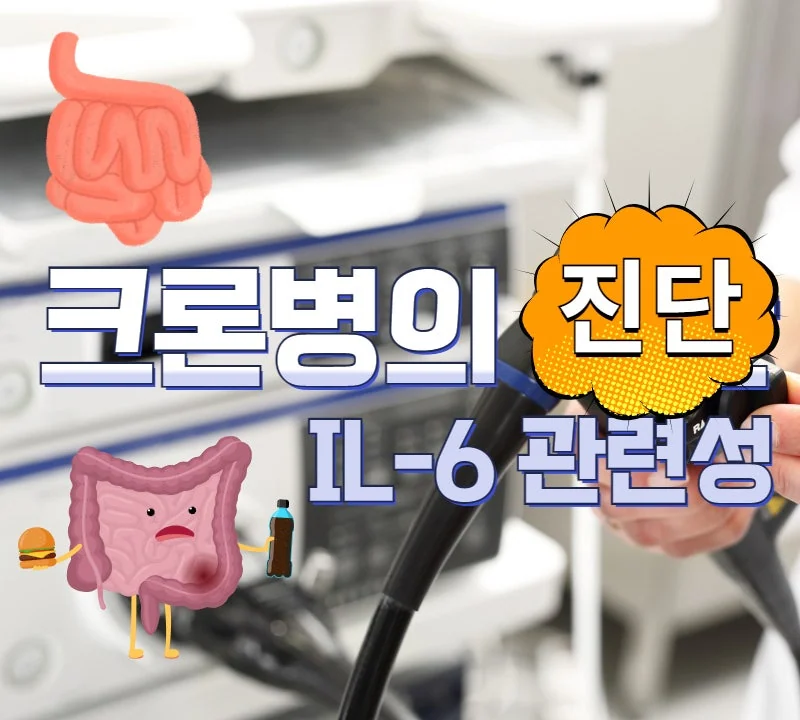 크론병Crohns disease, CD 진단과 I #1