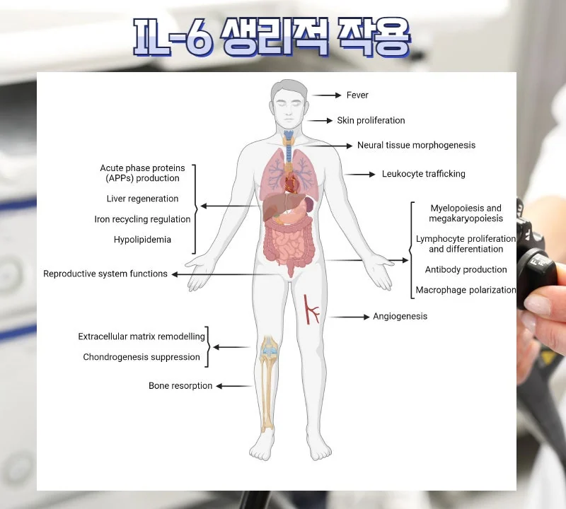 크론병Crohns disease, CD 진단과 I #5