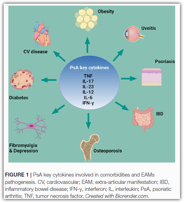 건선 관절염 - 심혈관 질환 발생 위험성 기타 증상
