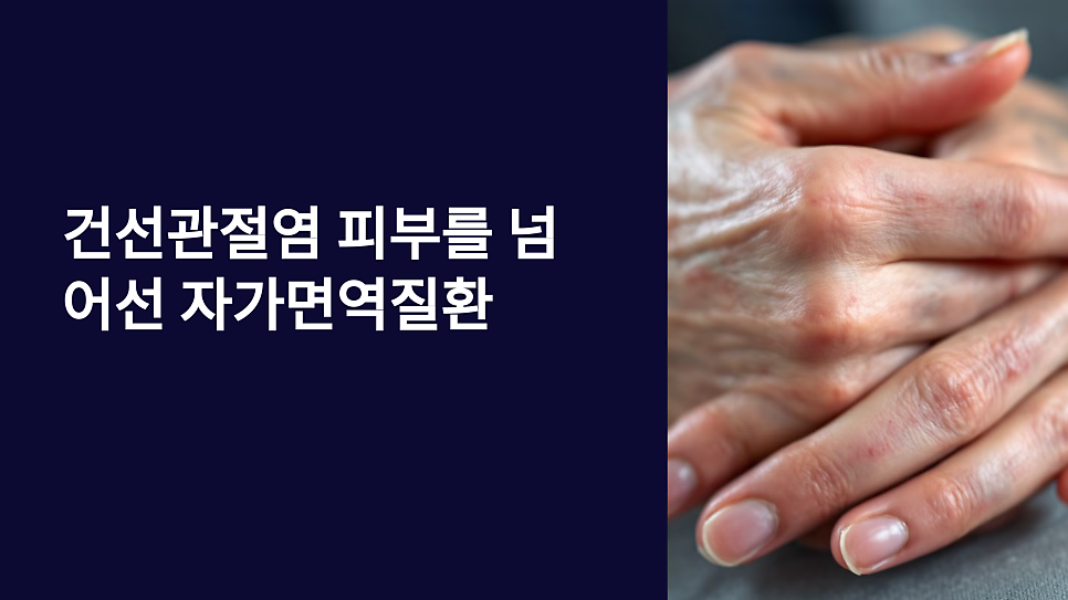 건선관절염의 증상 원인 임상 특징 최신 지견