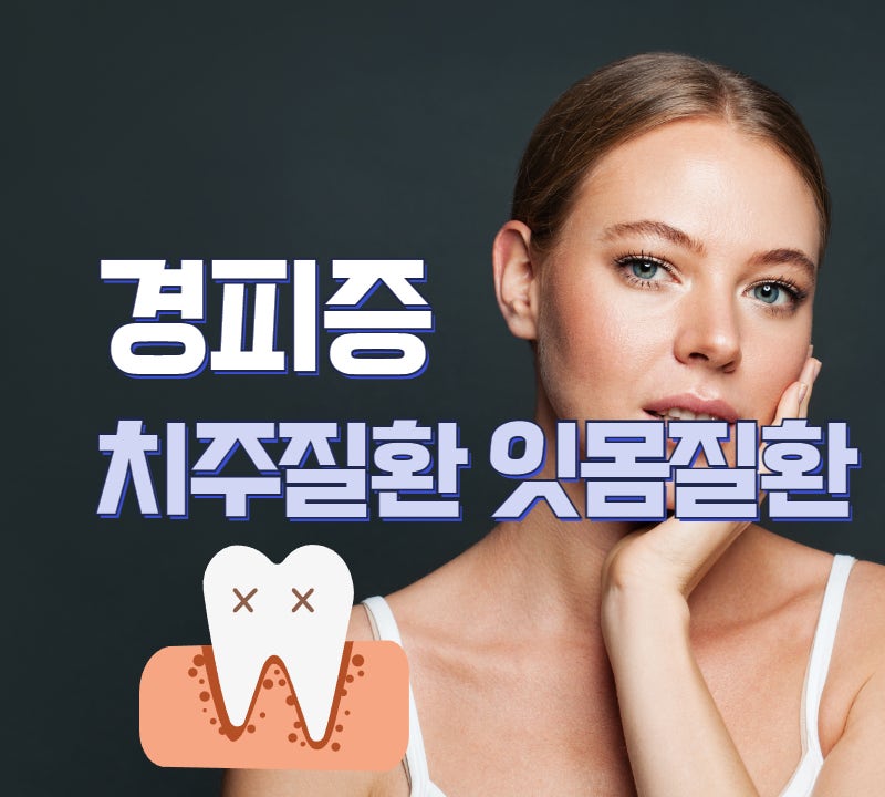 경피증 증상 중 잇몸 문제와 치주 질환은 어느정도일까