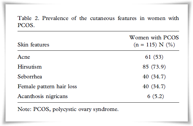 다낭성난소 증후군과 지루성 피부염