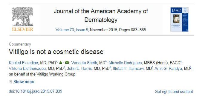 인천 백반증 치료, 단순한 피부질환이 아닌 자가면역질환입니다