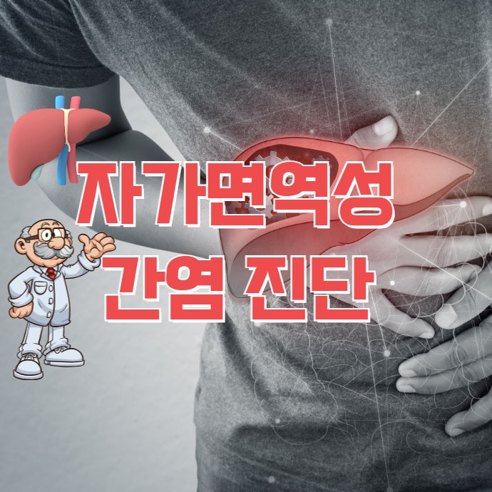 자가면역 간염(AIH) 예후와 진단 방법