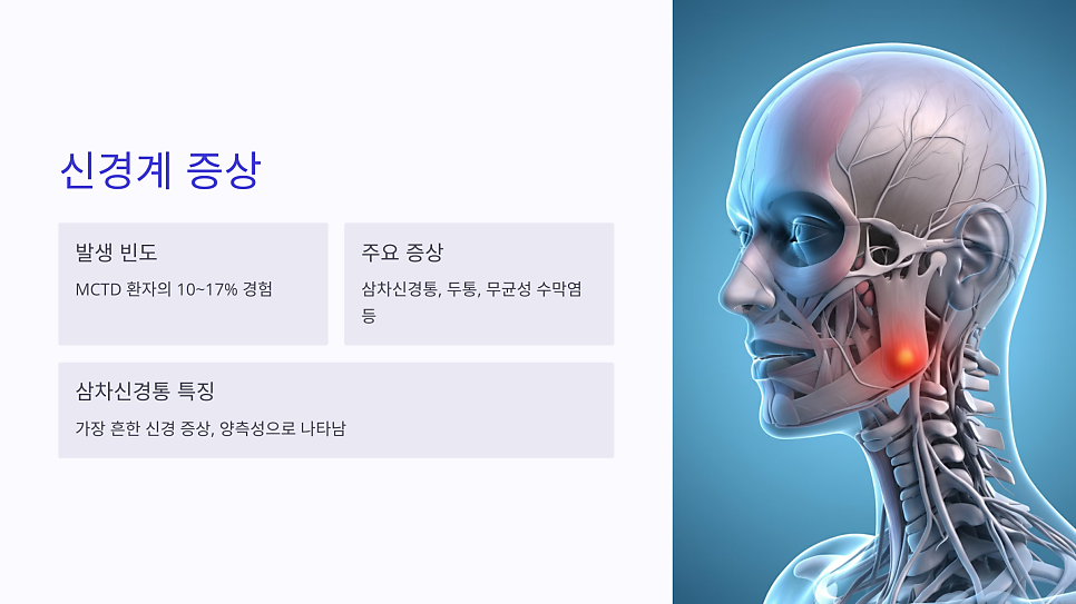 혼합결합조직병 증상 중 삼차신경통