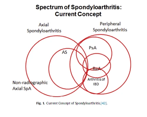 척추관절염spondyloarthritis, SpA #2