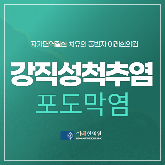 강직성 척추염 척추관절염에 나타나는 포도막염의 증상 예후는