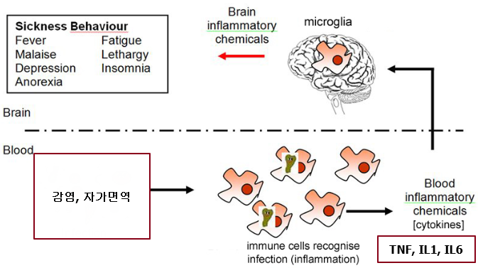 강직성척추염 동반되는 우울증