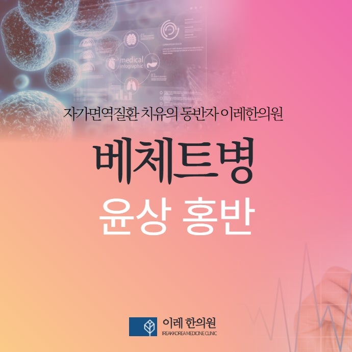 베체트병 주요 증상 중 윤상홍반