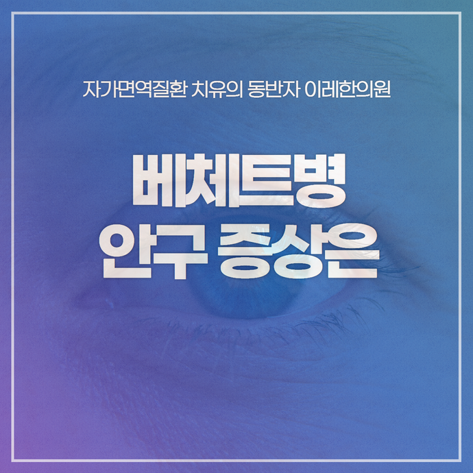 베체트병 증상 - 눈에 발생하는 안구 안과 질환은