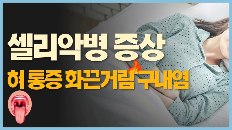 셀리악병 증상 중 입안에 발생하는 경우 : 구내염 혀 통증 그리고 위축 설염