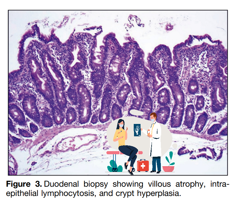 셀리악병 진단 소견
