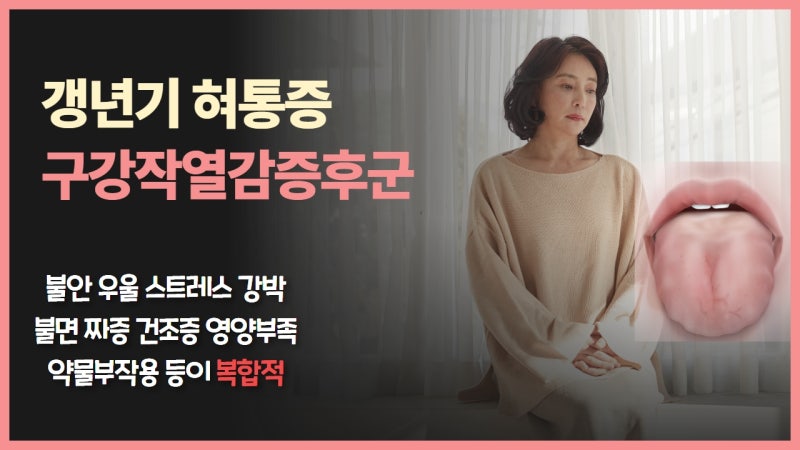 갱년기 구강작열감 치료