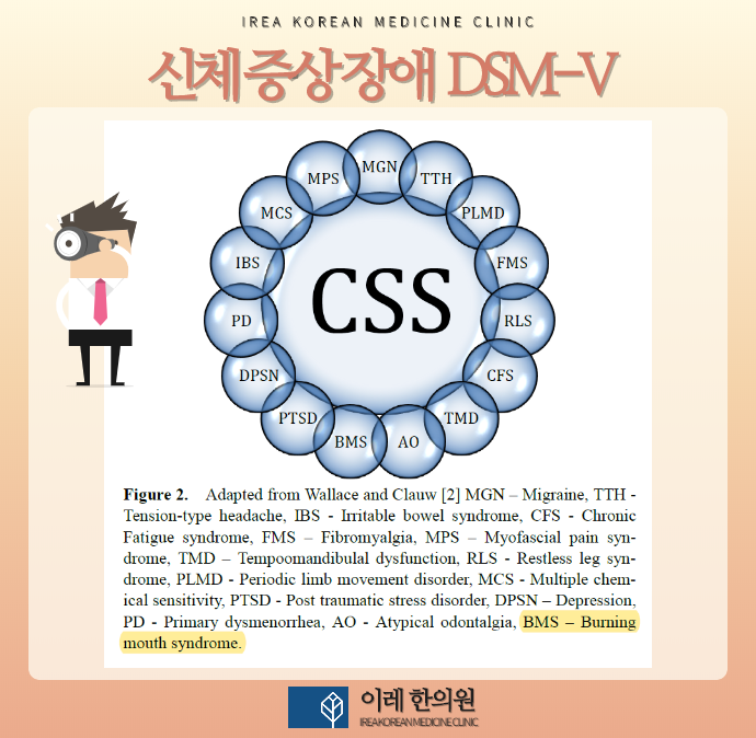 구강작열감증후군 중추감작