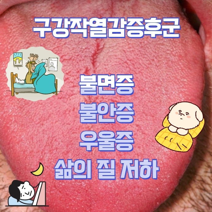 인지기능 저하와 BMS